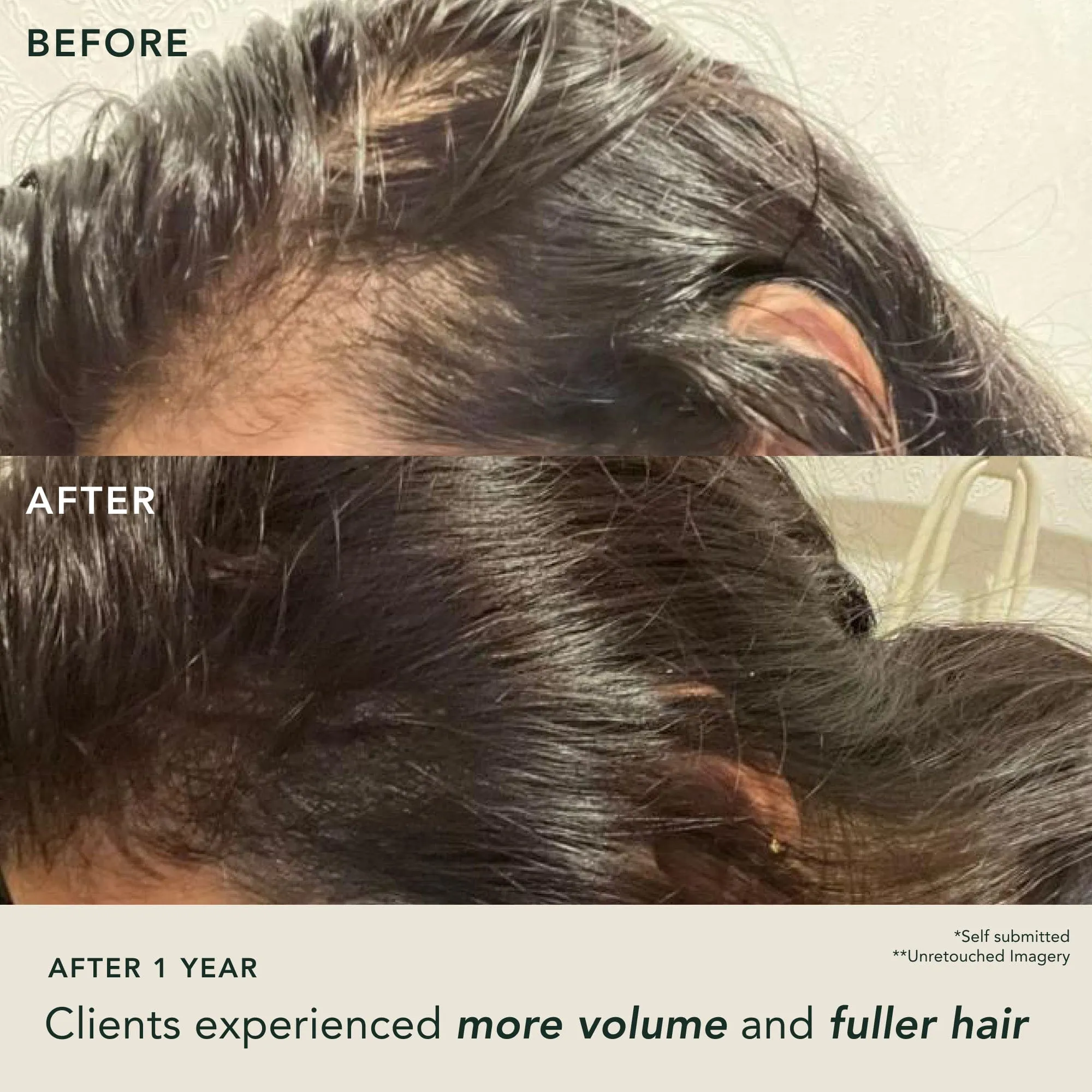 Fortifying Hair Serum Mini (15mL)